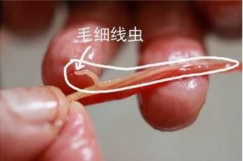 钓到有寄生虫的鱼咋办？常见的4种寄生虫，3种无害