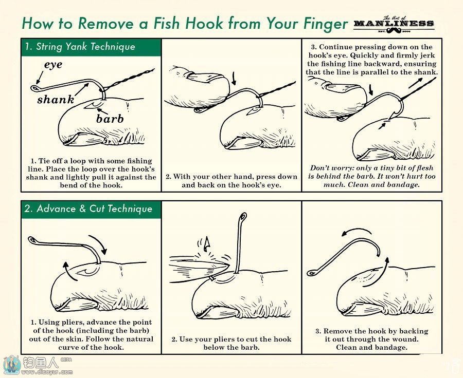 被鱼钩扎到后的一些实用处理方法